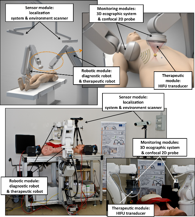 Image FUTURA platform for US-guided HIFU treatment